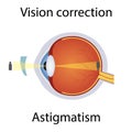 Vision Correction of Astigmatism Illustration. Eyesight Disorders. Eyes Defect Corrected by Lens Concept. Detailed