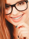 Happy nerdy teenage in eyeglasses showing braces