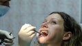 Visit to the dentist. A doctor orthodontist installs iron braces to a woman with a dental fixator and works with tools