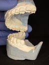 Visualisation of jaws defects on colored plastic model