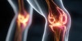 Knee joints illuminated in human body showing skeletal structure and pain relief aspects Royalty Free Stock Photo