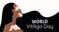 Vitiligo on the girl\'s face