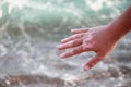 Vitiligo on the hand on the sea background