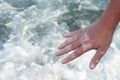 Vitiligo on the hand on the sea background