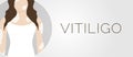 Vitiligo Skin Condition Illustration Banner Background Royalty Free Stock Photo