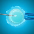 In vitro fertilization