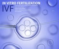 In Vitro Fertilization of Human Female Cell Macro