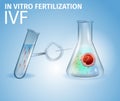 Methods of Infertility Treatment, IVF, Egg, Sperm