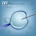 In Vitro Fertilization Royalty Free Stock Photo