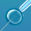 In vitro fertilization IVF , the egg ovum , pipette and pipe diagonal, reproduction in humans illustration