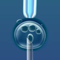 In vitro fertilization IVF , the egg ovum , pipette and pipe vertical, reproduction in humans illustration