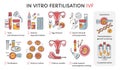 In Vitro fertilization IVF vector infographic and infertility treatment scheme