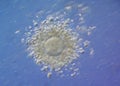 Miracle of life human ovum a spermatozoa, Microphotograpy FIV fertilization in vitro