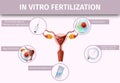 In Vitro Fertilization and Ovulation Background, Royalty Free Stock Photo