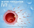 Spermatozoons Cells Flowing Toward Female Egg.