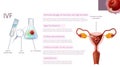 In Vitro Fertilization Stages. Medical Banner.