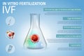 In Vitro Fertilization Stages Process Composition.