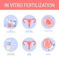 In vitro fertilization step-by-step method. Idea of infertility Royalty Free Stock Photo