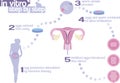 In vitro fertilization step by step