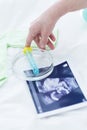 In vitro fertilization Royalty Free Stock Photo