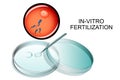 In-vitro fertilization. Royalty Free Stock Photo