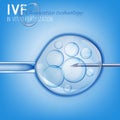 In Vitro Fertilization Royalty Free Stock Photo