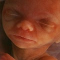 In vitro image of a human fetus in the womb Royalty Free Stock Photo