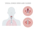 Vocal cords open and closed