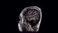 Voluminous color MRI scans of the brain and head to detect tumours. Diagnostic medical tool
