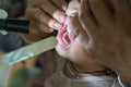 Volunteer nurse performing medical examination on poor Asian children