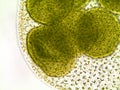 Volvox algae under microscope - 400x