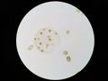 Volvox genus of chlorophyte green algae