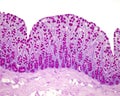 Colon mucosa. Goblet cells Royalty Free Stock Photo