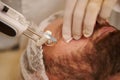 Prevention of the first signs of aging. Rejuvenation and anti-aging treatment. Man in beauty salon taking injections on his face Royalty Free Stock Photo