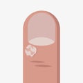 Wart on finger vector icon on white background