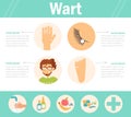 Wart. Types on the hand,