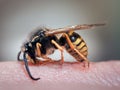 Wasp on a human hand. The sting of a wasp in the skin. Swelling, redness. macro Royalty Free Stock Photo