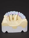 wax denture Royalty Free Stock Photo