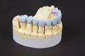 wax denture Royalty Free Stock Photo