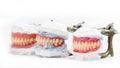 Wax denture,dental models showing different types