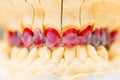 Wax Denture Royalty Free Stock Photo