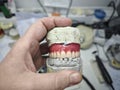 Wax frame of a removable denture and in the hands of a doctor