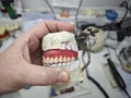 Wax frame of a removable denture and in the hands of a doctor