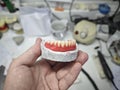 Wax frame of a removable denture and in the hands of a doctor