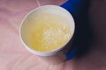 Wax for sugaring in a cosmetic jar in the hands of a master in a beauty salon.