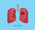 Weak lung cancer, character of dental