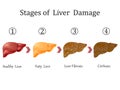 Stages of liver damage, liver disease. Healthy, fatty, liver fibrosis and cirrhosis isolated on white background.Vector illustrati