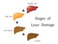 Stages of liver damage, liver disease. Healthy, fatty, liver fibrosis and cirrhosis isolated on white background.Round diagram.Vec