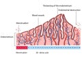 Changes in uterine endometrial destruction