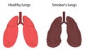 Healthy lungs and lungs of smoker